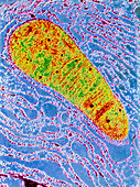 Colour TEM of mitochondrion,endoplasmic reticulum
