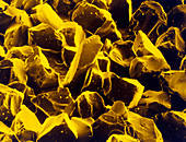 False-col SEM of surface of coarse sandpaper
