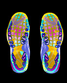 Coloured X-ray of the soles of two trainer shoes