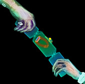 Coloured X-ray of hands pulling a party cracker