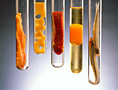 Fat-rich foods presented in test tubes
