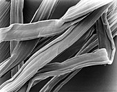 SEM of viscose from tampon