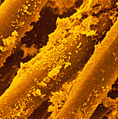 False-col SEM of bacteria on a used kitchen pad