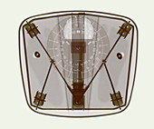 Bathroom scales X-ray