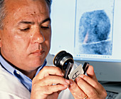 Examining fingerprint