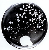 Culture plate made by Alexander Fleming