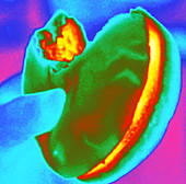 Thermogram of a hand holding a hamburger