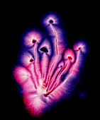 Kirlian photograph of liberty cap mushrooms