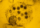 False-colour TEM of yellow fever viruses