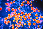 German measles viruses