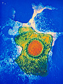 False-colour TEM of a Cytomegalovirus