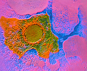 False-colour TEM of cytomegalovirus