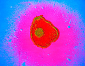 False-colour TEM of virion of herpes simplex