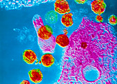 TEM of HIV viruses in T-cell
