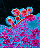 False-col TEM of AIDS virus budding from T-cell