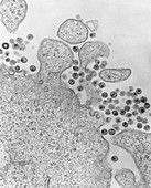 TEM of AIDS virus particles around infected T-cell