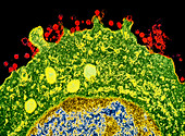 TEM of HIV-2 AIDS virus particles