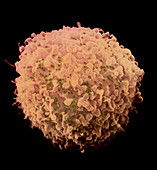 False-colour SEM of T-lymphocyte infected with HIV