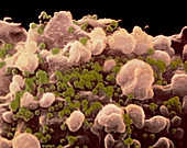 False colour SEM of T-lymphocyte infected with HIV