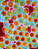 False-colour TEM of herpes simplex virions