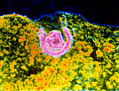 HIV virion entering a lymphocyte,TEM