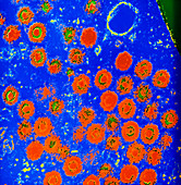 Coloured SEM of herpes simplex virus
