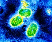 TEM of parapoxviruses