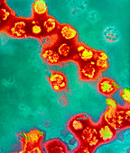 Coloured TEM of rubella virus particles