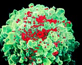 HIV viruses (red)