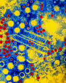 Coloured TEM: rotaviruses and astroviruses