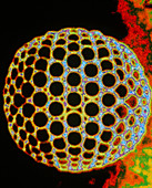 Computer graphic image of the HIV virus particle
