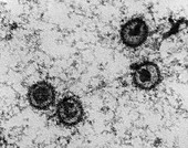 TEM of Epstein-Barr Virus