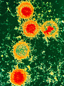 Coloured TEM of Epstein-Barr Virus