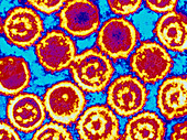 Coloured TEM of Epstein-Barr viruses