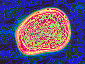 Coloured TEM of mumps virus,Rabula inflans