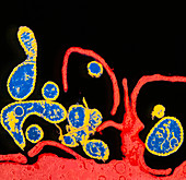 Coloured TEM of budding measles viruses