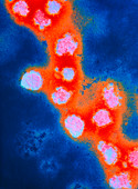 Coloured TEM of Rubella virus particles