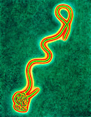 TEM of the ebola virus