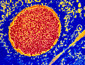 Coloured TEM of cell in measles encephalitis