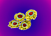 Transmission electron micrograph of herpes viruses