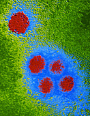 Coloured TEM of Dengue virus particles