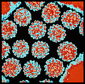 Coloured TEM of Papilloma viruses