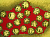 Coloured TEM of a group of rotaviruses