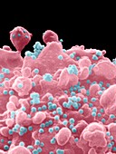 Coloured SEM of a T-cell infected with AIDS virus