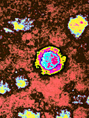 TEM of a Borna disease virus