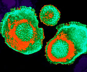 Coloured TEM of herpes simplex viruses