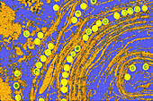 Coloured TEM of herpes simplex viruses inside cell