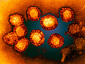 West Nile viruses