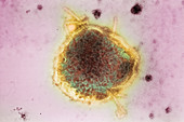 Measles virus