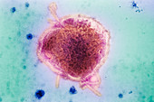 Measles virus